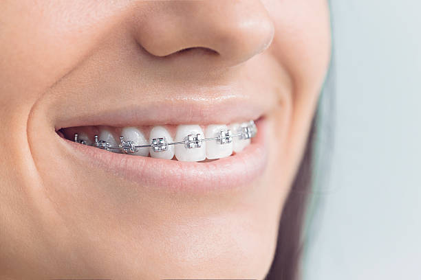 Best Invisalign and Clear Aligners  in Sam Rayburn, TX